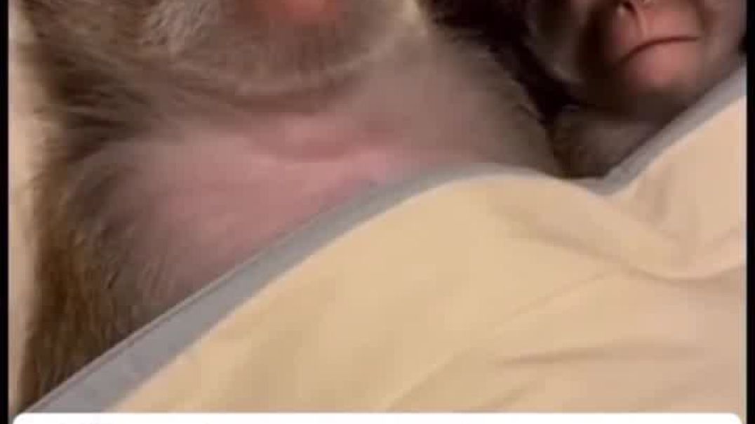 Common sleep apnea symptoms include loud snoring, pauses in breathing during sleep, gasping or c