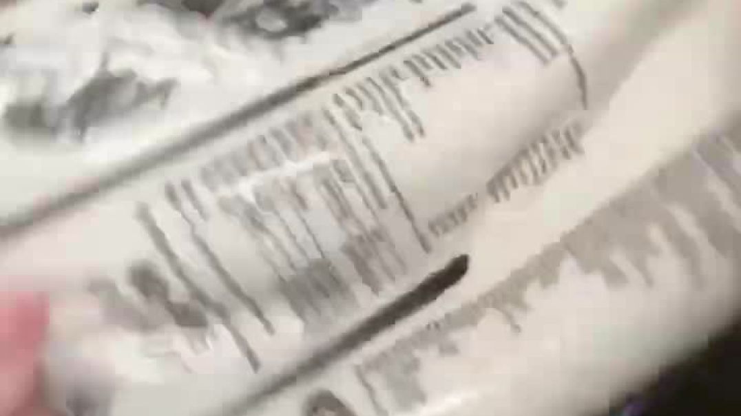 Total Parenteral Nutrition (TPN) bag